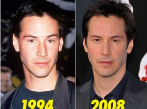 Keanu Plastic Surgery ?