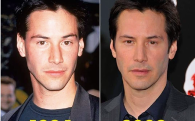 Keanu Reeves Plastic Surgery ?